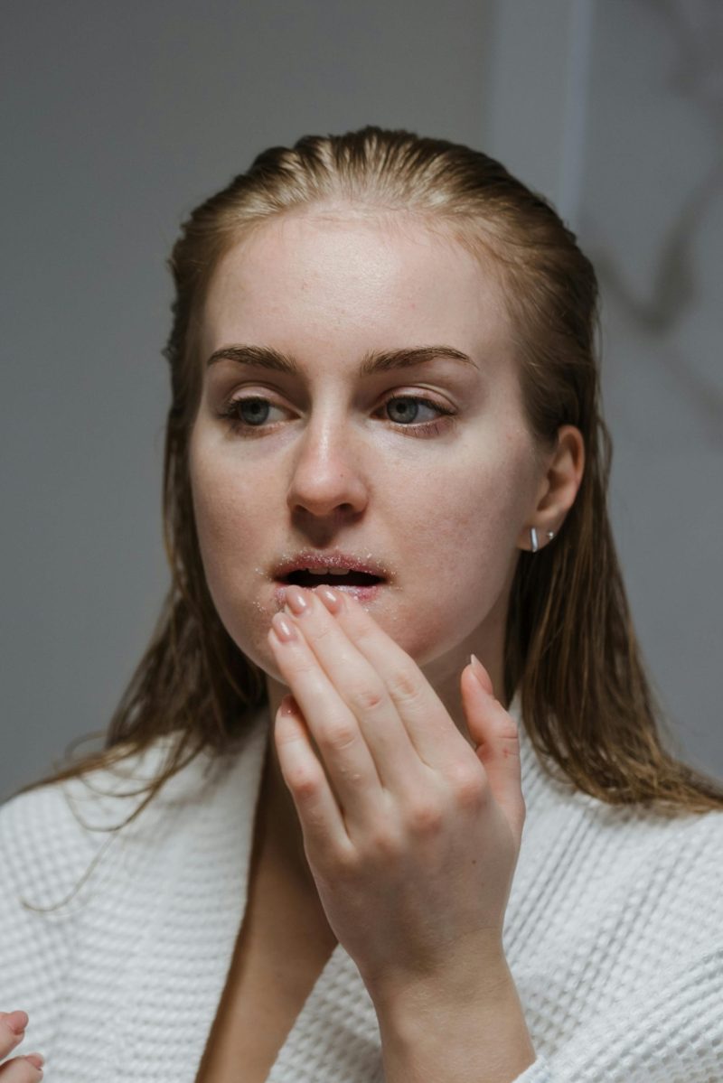 Home Remedy for Venous Lake on Lip: Natural Treatments That Actually Work 1 Home Remedy for Venous Lake on Lip: Natural Treatments That Actually Work